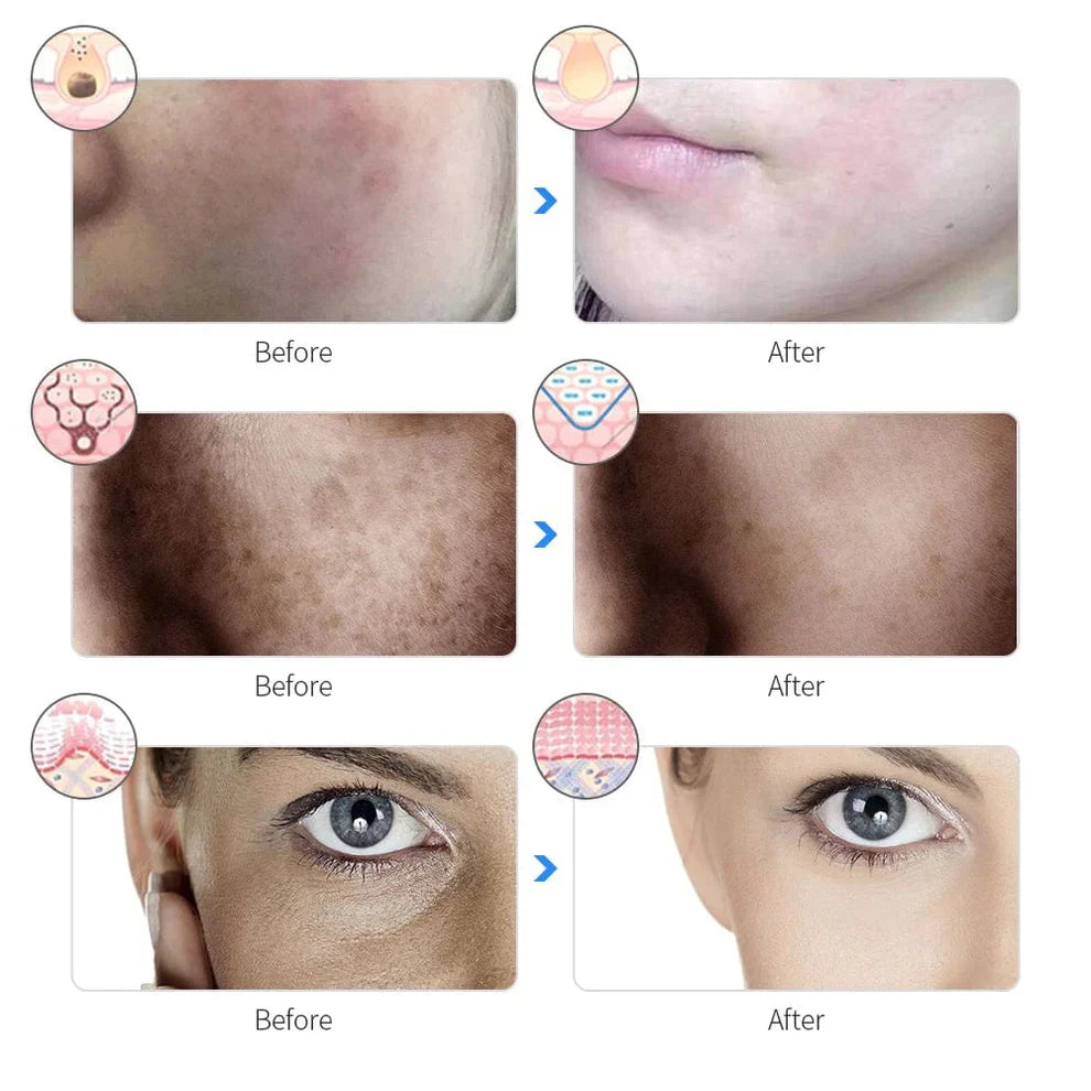 LUMMÉRAS LED Face Mask